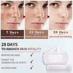 Freckle Lightening Whitening Cream