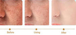 Freckle Lightening Whitening Cream